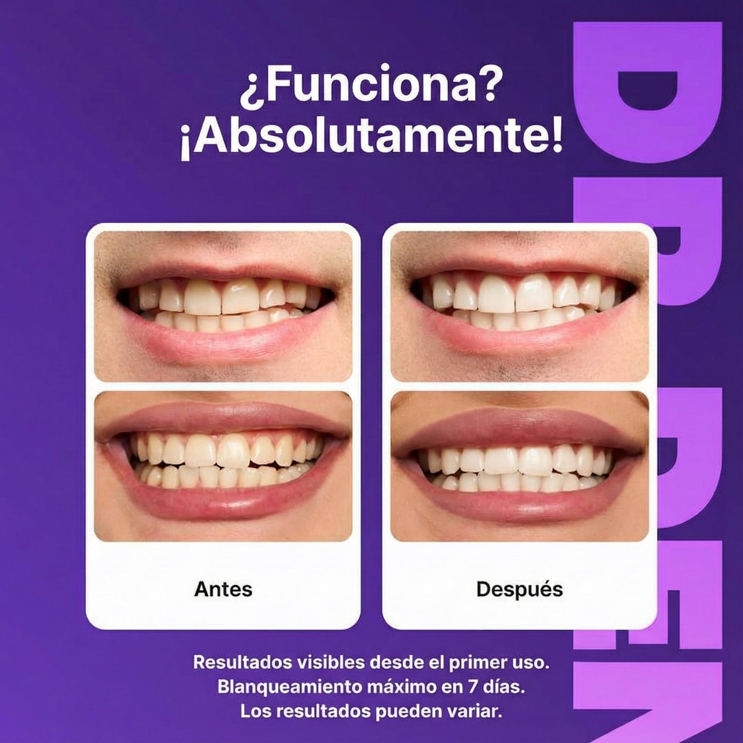 Artorax ProWhite™ Tiras Blanqueadoras