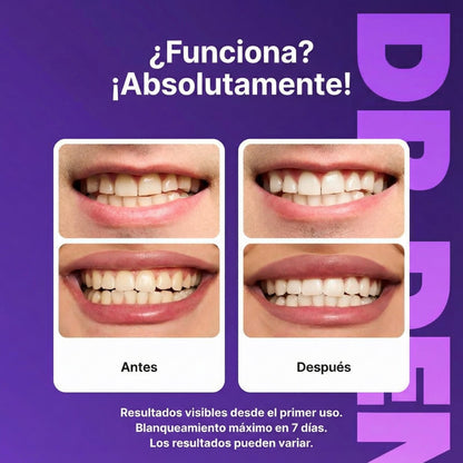 Artorax ProWhite™ Tiras Blanqueadoras